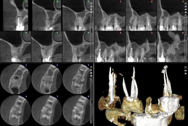 Setari Radiografii 3D CRANEX3D